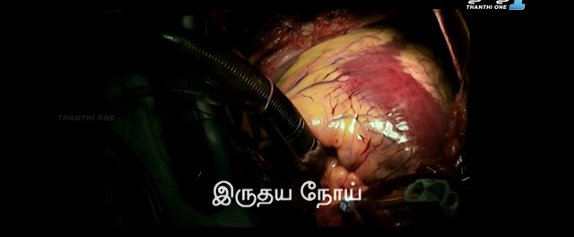 Moviesda.Mobi - Elektra 2010 Original 720p HD (800MB).mp4