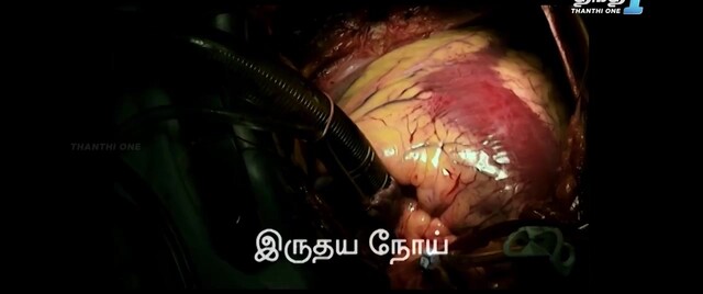 Moviesda.Mobi - Richie Kalyanam 2024 Original 720p HD.mp4